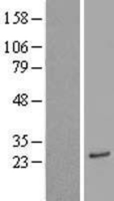 Western Blot: ASAH3 Overexpression Lysate (Adult Normal) [NBL1-07748] Left-Empty vector transfected control cell lysate (HEK293 cell lysate); Right -Over-expression Lysate for ASAH3.