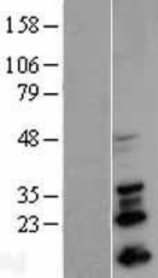 Western Blot: SNAIL Overexpression Lysate (Adult Normal) [NBL1-16265] Left-Empty vector transfected control cell lysate (HEK293 cell lysate); Right -Over-expression Lysate for SNAIL.
