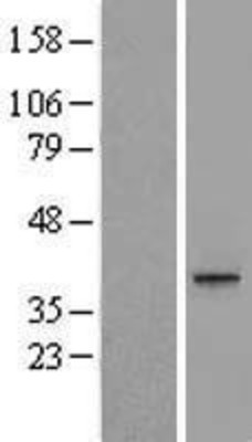 Western Blot: MEST Overexpression Lysate (Adult Normal) [NBL1-13016] Left-Empty vector transfected control cell lysate (HEK293 cell lysate); Right -Over-expression Lysate for MEST.