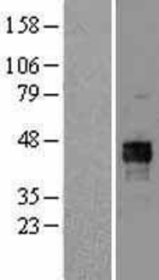Western Blot: Pyruvate Dehydrogenase E1-alpha subunit Overexpression Lysate (Adult Normal) [NBL1-14241] Left-Empty vector transfected control cell lysate (HEK293 cell lysate); Right -Over-expression Lysate for Pyruvate Dehydrogenase E1-alpha subunit.