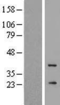 Western Blot: GCAP3 Overexpression Lysate (Adult Normal) [NBP2-10466] Left-Empty vector transfected control cell lysate (HEK293 cell lysate); Right -Over-expression Lysate for GCAP3.