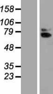 Western Blot: ACPL Overexpression Lysate (Adult Normal) [NBP2-10544] Left-Empty vector transfected control cell lysate (HEK293 cell lysate); Right -Over-expression Lysate for ACPL.