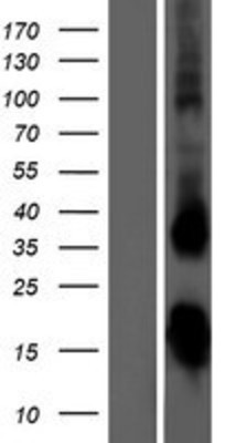 Western Blot: TSH beta Overexpression Lysate (Adult Normal) [NBP2-10682] Left-Empty vector transfected control cell lysate (HEK293 cell lysate); Right -Over-expression Lysate for TSH beta.