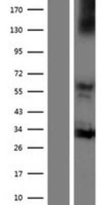 Western Blot: NOX3 Overexpression Lysate (Adult Normal) [NBP2-07120] Left-Empty vector transfected control cell lysate (HEK293 cell lysate); Right -Over-expression Lysate for NOX3.
