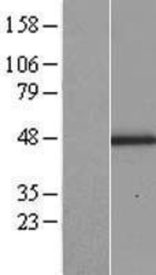 Western Blot: Lumican Overexpression Lysate (Adult Normal) [NBP2-10821] Left-Empty vector transfected control cell lysate (HEK293 cell lysate); Right -Over-expression Lysate for Lumican.