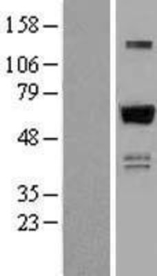 Western Blot: ZNF307 Overexpression Lysate (Adult Normal) [NBL1-18038] Left-Empty vector transfected control cell lysate (HEK293 cell lysate); Right -Over-expression Lysate for ZNF307.