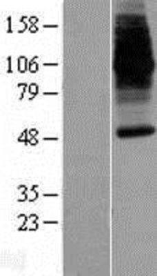 Western Blot: DMT1 Overexpression Lysate (Adult Normal) [NBP2-10692] Left-Empty vector transfected control cell lysate (HEK293 cell lysate); Right -Over-expression Lysate for DMT1.