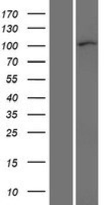 Western Blot: p120-catenin Overexpression Lysate (Adult Normal) [NBP2-10650] Left-Empty vector transfected control cell lysate (HEK293 cell lysate); Right -Over-expression Lysate for p120-catenin.