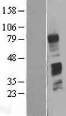 Western Blot: C4 binding protein B Overexpression Lysate (Adult Normal) [NBP2-10690] Left-Empty vector transfected control cell lysate (HEK293 cell lysate); Right -Over-expression Lysate for C4 binding protein B.