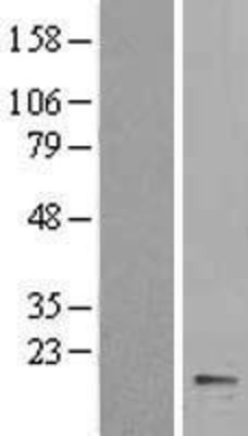 Western Blot: Cytochrome b5 type A Overexpression Lysate (Adult Normal) [NBL1-09651] Left-Empty vector transfected control cell lysate (HEK293 cell lysate); Right -Over-expression Lysate for Cytochrome b5 type A.