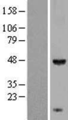 Western Blot: KCTD9 Overexpression Lysate (Adult Normal) [NBL1-12217] Left-Empty vector transfected control cell lysate (HEK293 cell lysate); Right -Over-expression Lysate for KCTD9.
