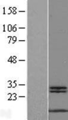Western Blot: MYCBP Overexpression Lysate (Adult Normal) [NBL1-13415] Left-Empty vector transfected control cell lysate (HEK293 cell lysate); Right -Over-expression Lysate for MYCBP.