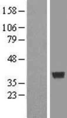 Western Blot: COPS6 Overexpression Lysate (Adult Normal) [NBL1-09384] Left-Empty vector transfected control cell lysate (HEK293 cell lysate); Right -Over-expression Lysate for COPS6.
