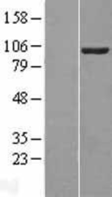 Western Blot: VAV2 Overexpression Lysate (Adult Normal) [NBL1-17702] Left-Empty vector transfected control cell lysate (HEK293 cell lysate); Right -Over-expression Lysate for VAV2.