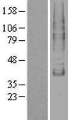 Western Blot: TM9SF1 Overexpression Lysate (Adult Normal) [NBP2-04310] Left-Empty vector transfected control cell lysate (HEK293 cell lysate); Right -Over-expression Lysate for TM9SF1.