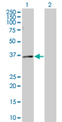 Lane 1: CA7 transfected lysate (29.04 KDa) Lane 2: Non-transfected lysate.
