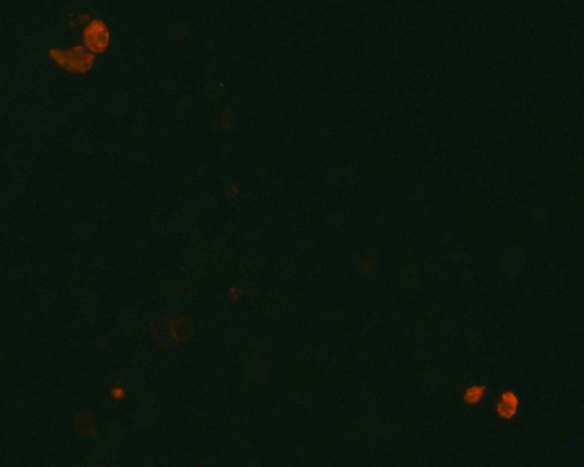 The plasmid was transfected into 293H adherent cells with Sinofection reagent (Cat# STF01). After 48 h, Immunofluorescence staining of cells. Cells were fixed with 4% PFA, permeabilzed with 0.3% Triton X-100 in PBS, blocked with 10% serum, and incubated with Mouse anti-Flag Tag monoclonal antibody (CST#8146S) at 37℃ 1 hour. Then cells were stained with Goat Anti-mouse IgG secondary antibody. The fluorescent signal is detected by fluorescence microscope. Each expression experiment has negative control.