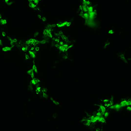 The plasmid was transfected into 293H adherent cells with Sinofection reagent (Cat# STF01). After 48 h, Immunofluorescence staining of cells. Cells were fixed with 4% PFA, permeabilzed with 0.3% Triton X-100 in PBS, blocked with 10% serum, and incubated with Mouse anti-Flag Tag monoclonal antibody (CST#8146S) at 37℃ 1 hour. Then cells were stained with Goat Anti-mouse IgG secondary antibody. The fluorescent signal is detected by fluorescence microscope. Each expression experiment has negative control.