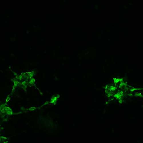 The plasmid was transfected into 293H adherent cells with Sinofection reagent (Cat# STF01). After 48 h, Immunofluorescence staining of cells. Cells were fixed with 4% PFA, permeabilzed with 0.3% Triton X-100 in PBS, blocked with 10% serum, and incubated with Mouse anti-Flag Tag monoclonal antibody (CST#8146S) at 37℃ 1 hour. Then cells were stained with Goat Anti-mouse IgG secondary antibody. The fluorescent signal is detected by fluorescence microscope. Each expression experiment has negative control.