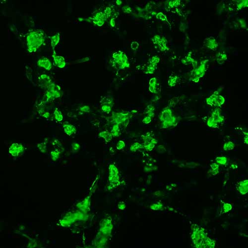 The plasmid was transfected into 293H adherent cells with Sinofection reagent (Cat# STF01). After 48 h, Immunofluorescence staining of cells. Cells were fixed with 4% PFA, permeabilzed with 0.3% Triton X-100 in PBS, blocked with 10% serum, and incubated with Mouse anti-Flag Tag monoclonal antibody (CST#8146S) at 37℃ 1 hour. Then cells were stained with Goat Anti-mouse IgG secondary antibody. The fluorescent signal is detected by fluorescence microscope. Each expression experiment has negative control.