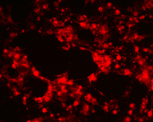 The plasmid was transfected into 293H adherent cells with Sinofection reagent (Cat#STF01) transiently. After 48 h, the fluorescent signals can be detected by fluorescence microscope. Green excitation 475/40nm, emission 535/45nm. Red excitation 560/55nm, emission 645/45nm. Orange excitation 525/45nm, emission 595/60nm.
