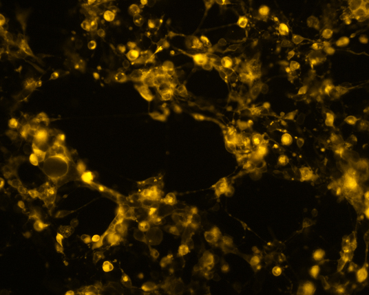The plasmid was transfected into 293H adherent cells with Sinofection reagent (Cat#STF01) transiently. After 48 h, the fluorescent signals can be detected by fluorescence microscope. Green excitation 475/40nm, emission 535/45nm. Red excitation 560/55nm, emission 645/45nm. Orange excitation 525/45nm, emission 595/60nm.