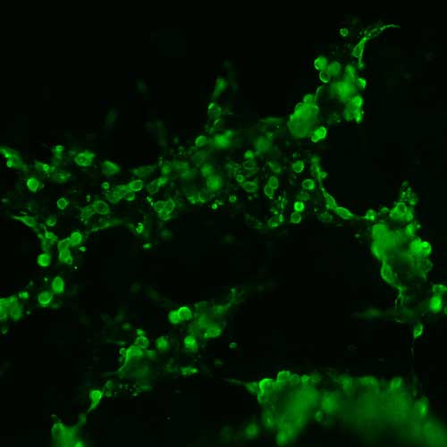 The plasmid was transfected into 293H adherent cells with Sinofection reagent (Cat# STF01). After 48 h, Immunofluorescence staining of cells. Cells were fixed with 4% PFA, permeabilzed with 0.3% Triton X-100 in PBS, blocked with 10% serum, and incubated with Mouse anti-Flag Tag monoclonal antibody (CST#8146S) at 37℃ 1 hour. Then cells were stained with Goat Anti-mouse IgG secondary antibody. The fluorescent signal is detected by fluorescence microscope. Each expression experiment has negative control.