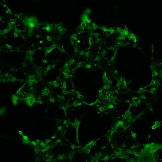 The plasmid was transfected into 293H adherent cells with Sinofection reagent (Cat# STF01). After 48 h, Immunofluorescence staining of cells. Cells were fixed with 4% PFA, permeabilzed with 0.3% Triton X-100 in PBS, blocked with 10% serum, and incubated with Mouse anti-Flag Tag monoclonal antibody (CST#8146S) at 37℃ 1 hour. Then cells were stained with Goat Anti-mouse IgG secondary antibody. The fluorescent signal is detected by fluorescence microscope. Each expression experiment has negative control.