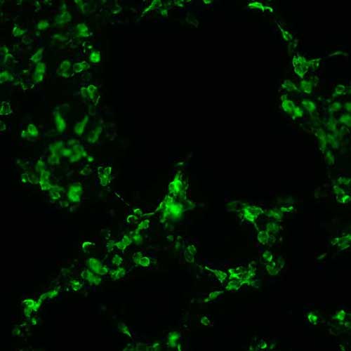 The plasmid was transfected into 293H adherent cells with Sinofection reagent (Cat# STF01). After 48 h, Immunofluorescence staining of cells. Cells were fixed with 4% PFA, permeabilzed with 0.3% Triton X-100 in PBS, blocked with 10% serum, and incubated with Mouse anti-Flag Tag monoclonal antibody (CST#8146S) at 37℃ 1 hour. Then cells were stained with Goat Anti-mouse IgG secondary antibody. The fluorescent signal is detected by fluorescence microscope. Each expression experiment has negative control.