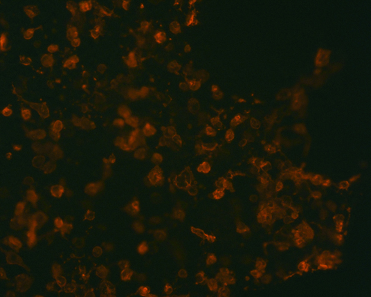 The plasmid was transfected into 293H adherent cells with Sinofection reagent (Cat# STF01). After 48 h, Immunofluorescence staining of cells. Cells were fixed with 4% PFA, permeabilzed with 0.3% Triton X-100 in PBS, blocked with 10% serum, and incubated with Mouse anti-Flag Tag monoclonal antibody (CST#8146S) at 37℃ 1 hour. Then cells were stained with Goat Anti-mouse IgG secondary antibody. The fluorescent signal is detected by fluorescence microscope. Each expression experiment has negative control.