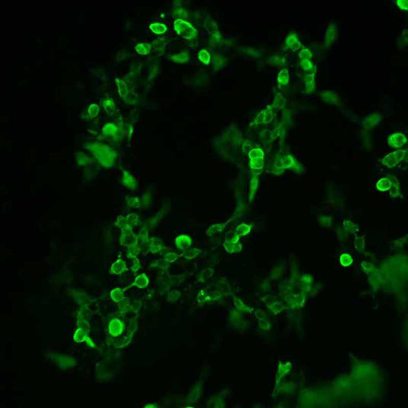 The plasmid was transfected into 293H adherent cells with Sinofection reagent (Cat# STF01). After 48 h, Immunofluorescence staining of cells. Cells were fixed with 4% PFA, permeabilzed with 0.3% Triton X-100 in PBS, blocked with 10% serum, and incubated with Mouse anti-Flag Tag monoclonal antibody (CST#8146S) at 37℃ 1 hour. Then cells were stained with Goat Anti-mouse IgG secondary antibody. The fluorescent signal is detected by fluorescence microscope. Each expression experiment has negative control.