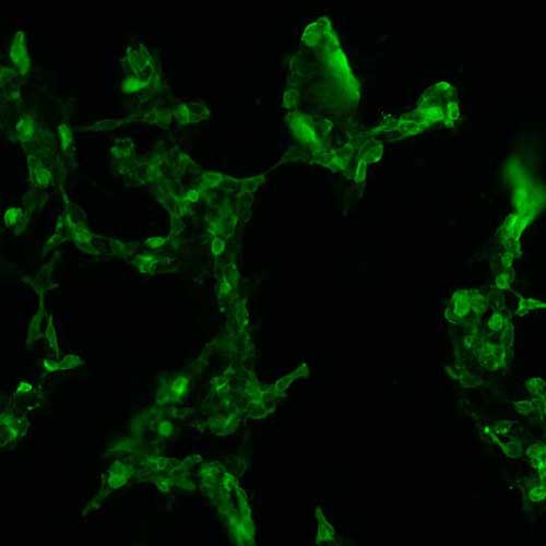 The plasmid was transfected into 293H adherent cells with Sinofection reagent (Cat# STF01). After 48 h, Immunofluorescence staining of cells. Cells were fixed with 4% PFA, permeabilzed with 0.3% Triton X-100 in PBS, blocked with 10% serum, and incubated with Mouse anti-Flag Tag monoclonal antibody (CST#8146S) at 37℃ 1 hour. Then cells were stained with Goat Anti-mouse IgG secondary antibody. The fluorescent signal is detected by fluorescence microscope. Each expression experiment has negative control.