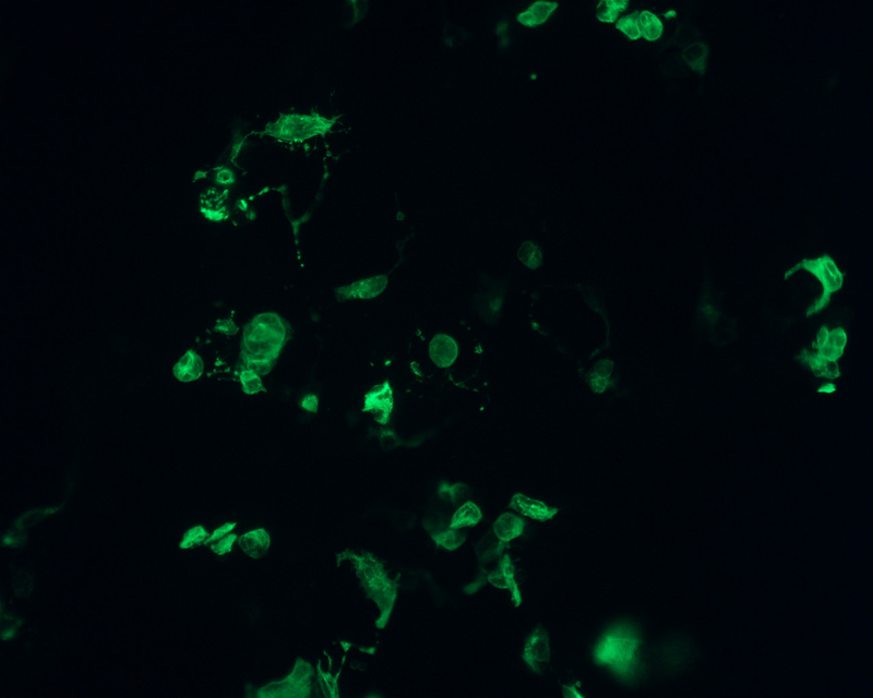 The plasmid was transfected into 293H adherent cells with Sinofection reagent (Cat# STF01). After 48 h, Immunofluorescence staining of cells. Cells were fixed with 4% PFA, permeabilzed with 0.3% Triton X-100 in PBS, blocked with 10% serum, and incubated with Mouse anti-Flag Tag monoclonal antibody (CST#8146S) at 37℃ 1 hour. Then cells were stained with Goat Anti-mouse IgG secondary antibody. The fluorescent signal is detected by fluorescence microscope. Each expression experiment has negative control.