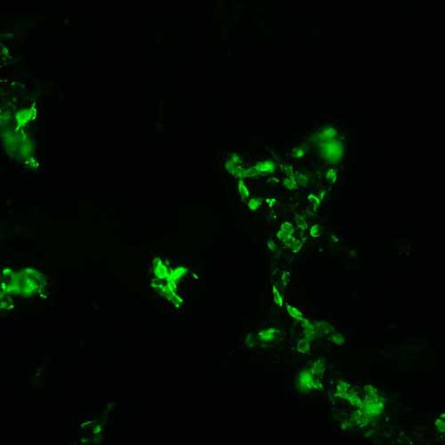 The plasmid was transfected into 293H adherent cells with Sinofection reagent (Cat# STF01). After 48 h, Immunofluorescence staining of cells. Cells were fixed with 4% PFA, permeabilzed with 0.3% Triton X-100 in PBS, blocked with 10% serum, and incubated with Mouse anti-Flag Tag monoclonal antibody (CST#8146S) at 37℃ 1 hour. Then cells were stained with Goat Anti-mouse IgG secondary antibody. The fluorescent signal is detected by fluorescence microscope. Each expression experiment has negative control.