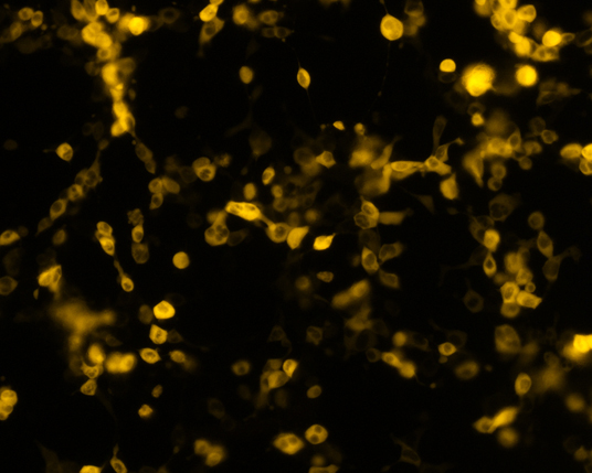 The plasmid was transfected into 293H adherent cells with Sinofection reagent (Cat#STF01) transiently. After 48 h, the fluorescent signals can be detected by fluorescence microscope. Green excitation 475/40nm, emission 535/45nm. Red excitation 560/55nm, emission 645/45nm. Orange excitation 525/45nm, emission 595/60nm.