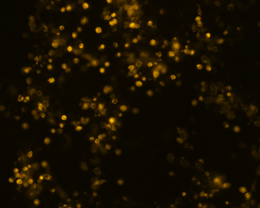 The plasmid was transfected into 293H adherent cells with Sinofection reagent (Cat#STF01) transiently. After 48 h, the fluorescent signals can be detected by fluorescence microscope. Green excitation 475/40nm, emission 535/45nm. Red excitation 560/55nm, emission 645/45nm. Orange excitation 525/45nm, emission 595/60nm.
