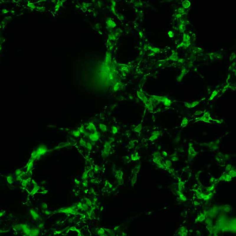 The plasmid was transfected into 293H adherent cells with Sinofection reagent (Cat# STF01). After 48 h, Immunofluorescence staining of cells. Cells were fixed with 4% PFA, permeabilzed with 0.3% Triton X-100 in PBS, blocked with 10% serum, and incubated with Mouse anti-Flag Tag monoclonal antibody (CST#8146S) at 37℃ 1 hour. Then cells were stained with Goat Anti-mouse IgG secondary antibody. The fluorescent signal is detected by fluorescence microscope. Each expression experiment has negative control.