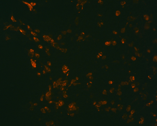 The plasmid was transfected into 293H adherent cells with Sinofection reagent (Cat# STF01). After 48 h, Immunofluorescence staining of cells. Cells were fixed with 4% PFA, permeabilzed with 0.3% Triton X-100 in PBS, blocked with 10% serum, and incubated with Mouse anti-Flag Tag monoclonal antibody (CST#8146S) at 37℃ 1 hour. Then cells were stained with Goat Anti-mouse IgG secondary antibody. The fluorescent signal is detected by fluorescence microscope. Each expression experiment has negative control.