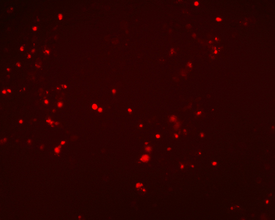 The plasmid was transfected into 293H adherent cells with Sinofection reagent (Cat#STF01) transiently. After 48 h, the fluorescent signals can be detected by fluorescence microscope. Green excitation 475/40nm, emission 535/45nm. Red excitation 560/55nm, emission 645/45nm. Orange excitation 525/45nm, emission 595/60nm.