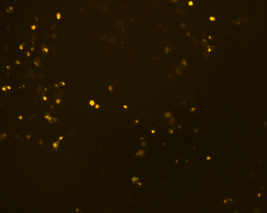 The plasmid was transfected into 293H adherent cells with Sinofection reagent (Cat#STF01) transiently. After 48 h, the fluorescent signals can be detected by fluorescence microscope. Green excitation 475/40nm, emission 535/45nm. Red excitation 560/55nm, emission 645/45nm. Orange excitation 525/45nm, emission 595/60nm.