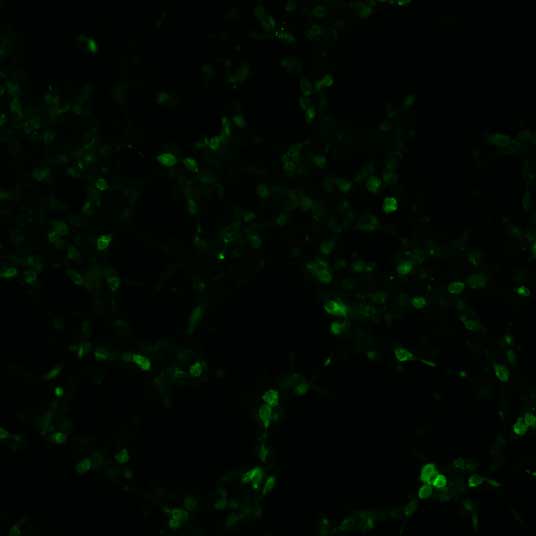 The plasmid was transfected into 293H adherent cells with Sinofection reagent (Cat# STF01). After 48 h, Immunofluorescence staining of cells. Cells were fixed with 4% PFA, permeabilzed with 0.3% Triton X-100 in PBS, blocked with 10% serum, and incubated with Mouse anti-Flag Tag monoclonal antibody (CST#8146S) at 37℃ 1 hour. Then cells were stained with Goat Anti-mouse IgG secondary antibody. The fluorescent signal is detected by fluorescence microscope. Each expression experiment has negative control.