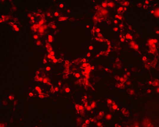 The plasmid was transfected into 293H adherent cells with Sinofection reagent (Cat#STF01) transiently. After 48 h, the fluorescent signals can be detected by fluorescence microscope. Green excitation 475/40nm, emission 535/45nm. Red excitation 560/55nm, emission 645/45nm. Orange excitation 525/45nm, emission 595/60nm.