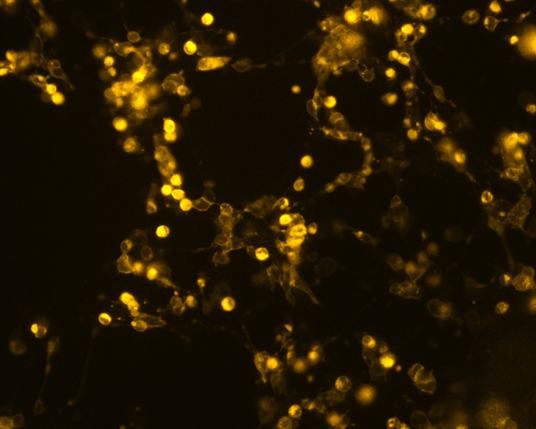 The plasmid was transfected into 293H adherent cells with Sinofection reagent (Cat#STF01) transiently. After 48 h, the fluorescent signals can be detected by fluorescence microscope. Green excitation 475/40nm, emission 535/45nm. Red excitation 560/55nm, emission 645/45nm. Orange excitation 525/45nm, emission 595/60nm.