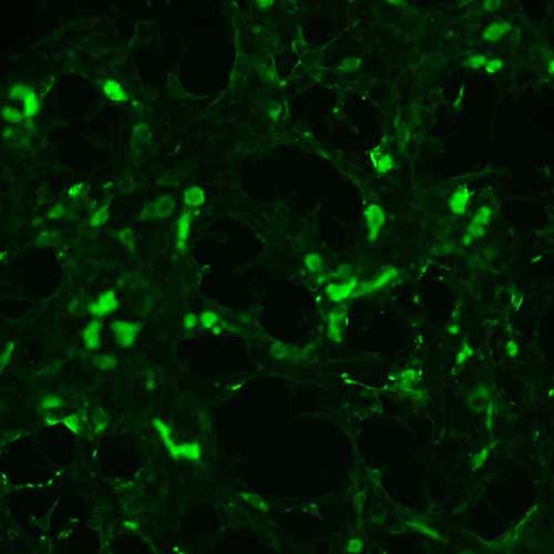 The plasmid was transfected into 293H adherent cells with Sinofection reagent (Cat# STF01). After 48 h, Immunofluorescence staining of cells. Cells were fixed with 4% PFA, permeabilzed with 0.3% Triton X-100 in PBS, blocked with 10% serum, and incubated with Mouse anti-Flag Tag monoclonal antibody (CST#8146S) at 37℃ 1 hour. Then cells were stained with Goat Anti-mouse IgG secondary antibody. The fluorescent signal is detected by fluorescence microscope. Each expression experiment has negative control.