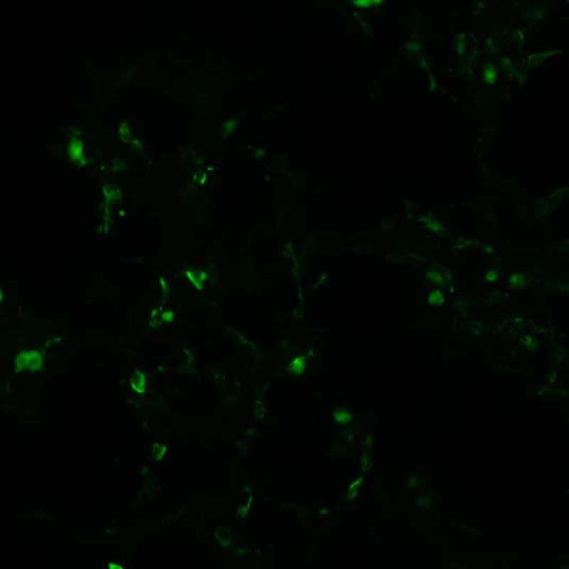 The plasmid was transfected into 293H adherent cells with Sinofection reagent (Cat# STF01). After 48 h, Immunofluorescence staining of cells. Cells were fixed with 4% PFA, permeabilzed with 0.3% Triton X-100 in PBS, blocked with 10% serum, and incubated with Mouse anti-Flag Tag monoclonal antibody (CST#8146S) at 37℃ 1 hour. Then cells were stained with Goat Anti-mouse IgG secondary antibody. The fluorescent signal is detected by fluorescence microscope. Each expression experiment has negative control.