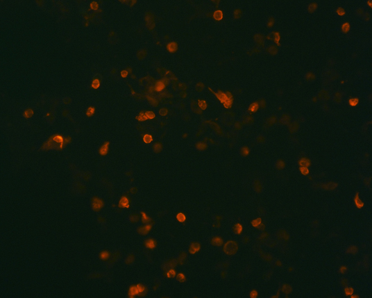 The plasmid was transfected into 293H adherent cells with Sinofection reagent (Cat# STF01). After 48 h, Immunofluorescence staining of cells. Cells were fixed with 4% PFA, permeabilzed with 0.3% Triton X-100 in PBS, blocked with 10% serum, and incubated with Mouse anti-Flag Tag monoclonal antibody (CST#8146S) at 37℃ 1 hour. Then cells were stained with Goat Anti-mouse IgG secondary antibody. The fluorescent signal is detected by fluorescence microscope. Each expression experiment has negative control.