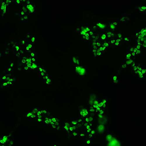 The plasmid was transfected into 293H adherent cells with Sinofection reagent (Cat# STF01). After 48 h, Immunofluorescence staining of cells. Cells were fixed with 4% PFA, permeabilzed with 0.3% Triton X-100 in PBS, blocked with 10% serum, and incubated with Mouse anti-Flag Tag monoclonal antibody (CST#8146S) at 37℃ 1 hour. Then cells were stained with Goat Anti-mouse IgG secondary antibody. The fluorescent signal is detected by fluorescence microscope. Each expression experiment has negative control.