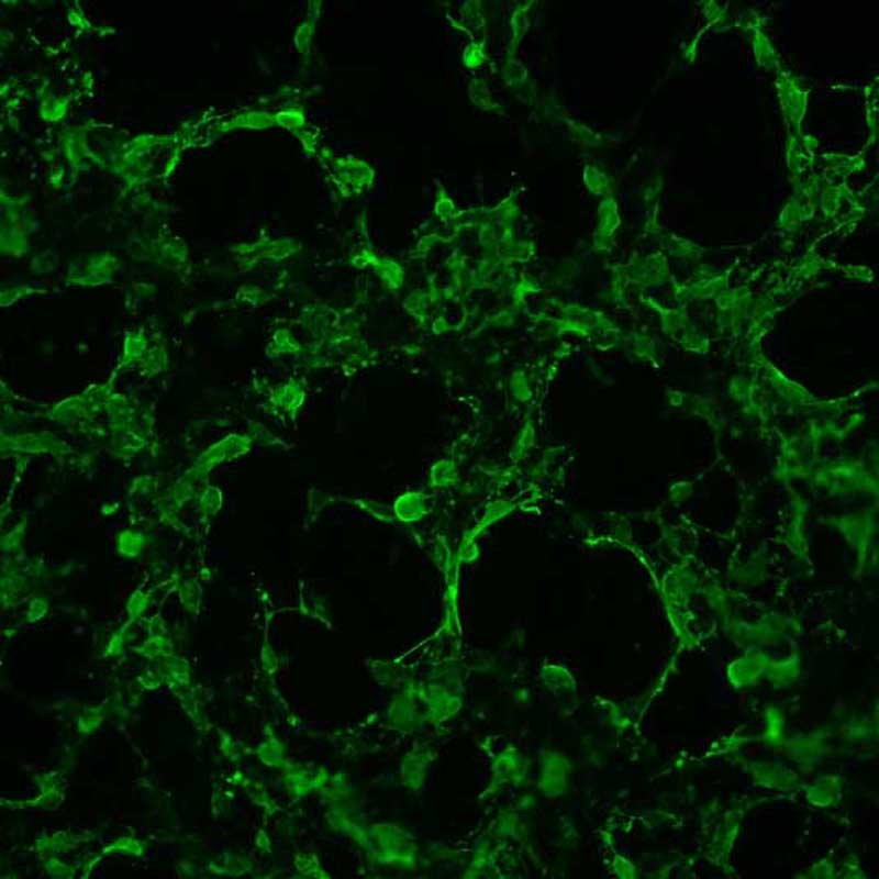 The plasmid was transfected into 293H adherent cells with Sinofection reagent (Cat# STF01). After 48 h, Immunofluorescence staining of cells. Cells were fixed with 4% PFA, permeabilzed with 0.3% Triton X-100 in PBS, blocked with 10% serum, and incubated with Mouse anti-Flag Tag monoclonal antibody (CST#8146S) at 37℃ 1 hour. Then cells were stained with Goat Anti-mouse IgG secondary antibody. The fluorescent signal is detected by fluorescence microscope. Each expression experiment has negative control.