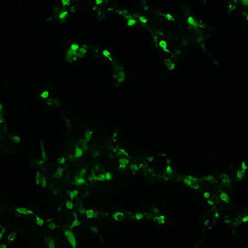 The plasmid was transfected into 293H adherent cells with Sinofection reagent (Cat# STF01). After 48 h, Immunofluorescence staining of cells. Cells were fixed with 4% PFA, permeabilzed with 0.3% Triton X-100 in PBS, blocked with 10% serum, and incubated with Mouse anti-Flag Tag monoclonal antibody (CST#8146S) at 37℃ 1 hour. Then cells were stained with Goat Anti-mouse IgG secondary antibody. The fluorescent signal is detected by fluorescence microscope. Each expression experiment has negative control.