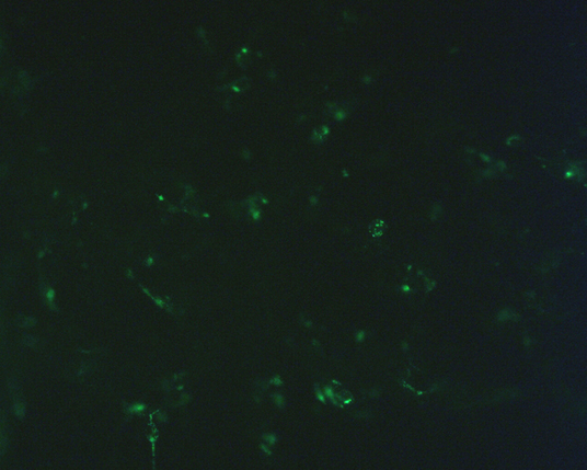 The plasmid was transfected into 293H adherent cells with Sinofection reagent (Cat# STF01). After 48 h, Immunofluorescence staining of cells. Cells were fixed with 4% PFA, permeabilzed with 0.3% Triton X-100 in PBS, blocked with 10% serum, and incubated with Mouse anti-Flag Tag monoclonal antibody (CST#8146S) at 37℃ 1 hour. Then cells were stained with Goat Anti-mouse IgG secondary antibody. The fluorescent signal is detected by fluorescence microscope. Each expression experiment has negative control.